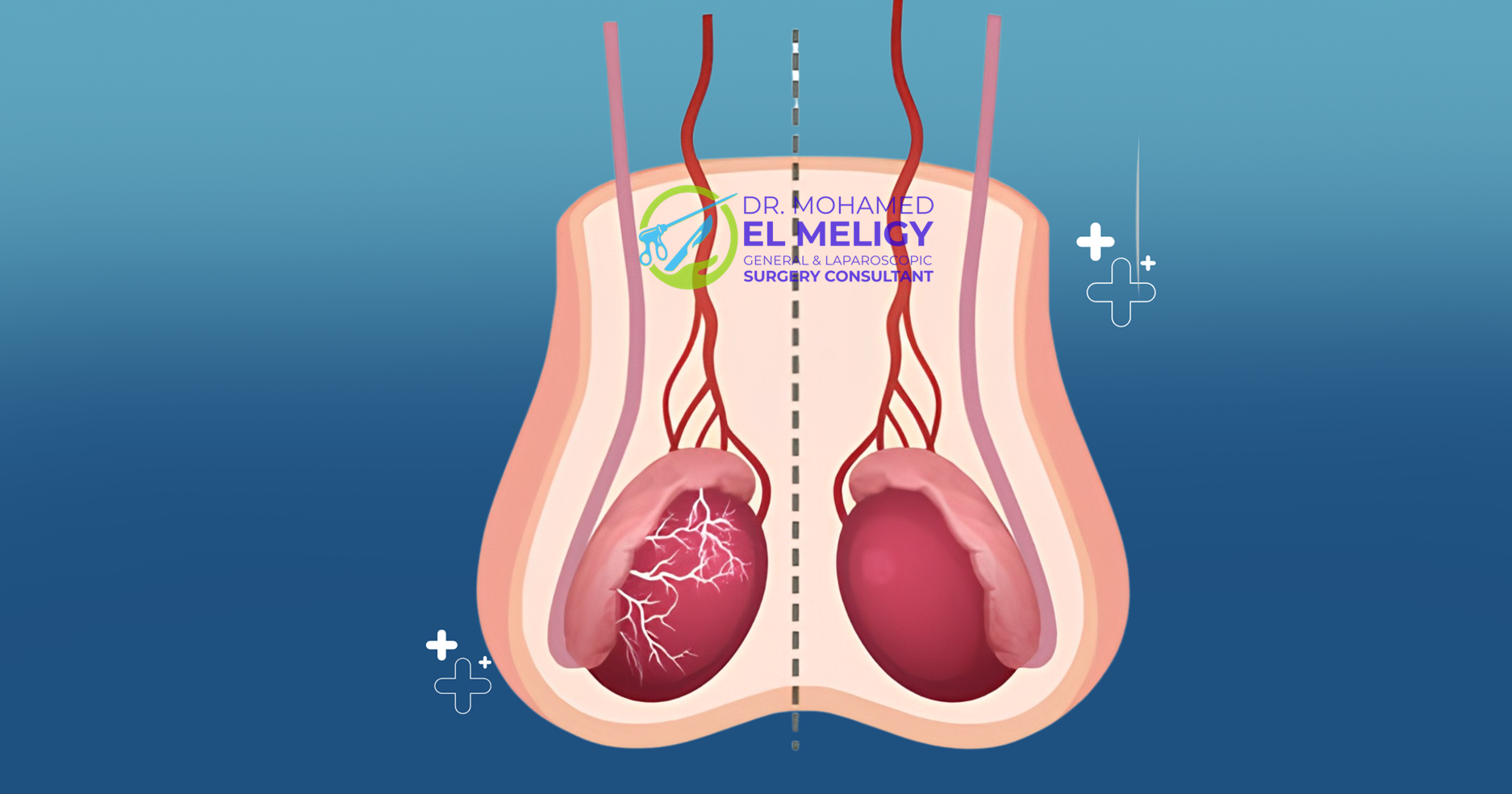 جراحات الذكورة والأوعية